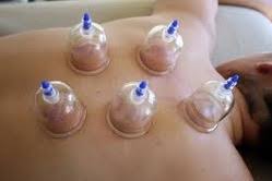 See full list on acucure.ca Cupping Therapy In Sindi Colony Secunderabad Id 3587933788