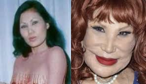 May lynn — vladiq limonadiq. Lyn May Antes Y Despues La Impactante Transformacion De La Artista Mexicana Desfigurada Por Las Cirugias Guioteca