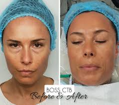 Boss Cosmetic Tattooing & Beauty