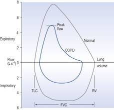 Peak Expiratory Flow An Overview Sciencedirect Topics