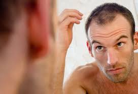 Beaucoup d'hommes commencent à perdre leurs cheveux à un moment donné de leur vie. Quels Sont Les Causes De La Calvitie
