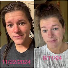 Dose liver supplement, a new crepe skin lotion, and the new Dixie tank.