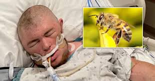 Ohio: Man stung 20,000 times by bees wakes up from coma