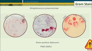 Image result for CSF Culture