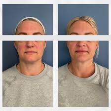 Truyu Aesthetic Center