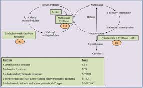 Image result for Homocystinuria