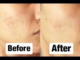 Maybe you would like to learn more about one of these? Pin On Beauty