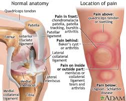 Knee Pain Medlineplus Medical Encyclopedia
