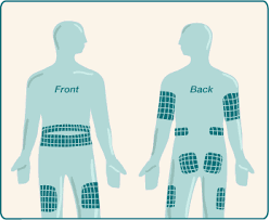 insulin rotating your injection sites insulin injection