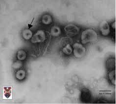 Bila berhasil mengeluarkan sinyal tersebut tepat waktu, maka tubuh dapat mematikan virus corona dan membuat respons imun yang sangat baik. Virus Corona Coronavirus Tribunnewswiki Com Mobile