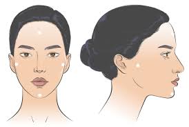 Perioral dermatitis — Medical Secrets