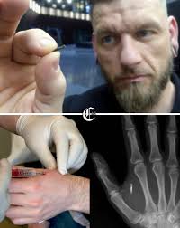 🇹🇭🩼🐘🧑🏻‍🔬Con solo siete meses, Mosha pisó una mina terrestre en la  selva de Tailandia y perdió parte de su pata delantera, pero en lugar de  rendirse, se convirtió en el primer elefante