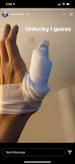 Sen Tenz spilt burning hot water on his left hand : rValorantCompetitive