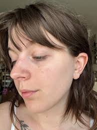 How to get rid of dark spots