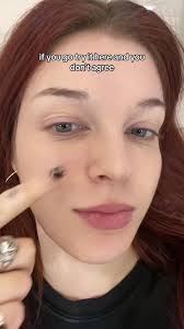 Just got the Rejuran Healer Injection, and my skin already feels fresh...