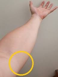 This is because you use your tendons when using your hands, which causes pain to radiate up into your elbow. Elbow Tendonitis Exercises Updated 2020 Posture Direct