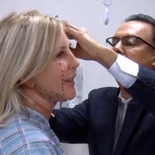 'The Real Housewives of Orange County': Vicki and Shannon go under the  knife and Tamra does something nasty