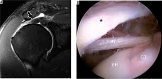 Image result for Shoulder Imaging