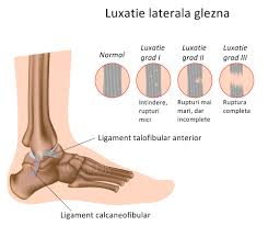 We did not find results for: Dureri Musculare La Nivelul Picioarelor Èi ArticulaÈiilor Artroza ArticulaÈiilor Acromioclaviculare