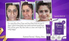Keinget pas ramenya skin care ms glow di pasaran, pasti cewek cewek bakalan goyah banget sama testimoninya yang bangus banget. Is Your Skin With Uneven Skin Glow Skin White Kulim Facebook