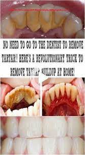 Designed to deep clean gums. No Need To Go To The Dentist To Remove Tartar Heres A Revolutionary Trick To Remove Tartar Teeth Health Remove Tartar Dentist