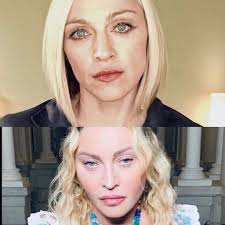 Learn about the ten most frequently performed cosmetic surgeries in the united states. Madonna Rare Page 134 News Discussion Madonna Infinity