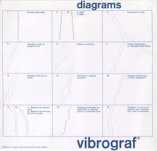 Diagrams Of Vibograf B200 Chart This Chart Shows The Errors In The Watch Movement Machine For Clocks There Is Another Mic Horology Watch Movement Clock
