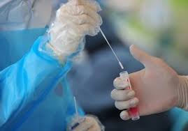 Copan Flocked Swab Yields Better Diagnostics Improves Patient Care