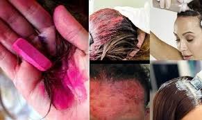 Những mối nguy hại xung quanh thuốc nhuộm tóc