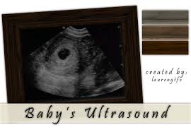 Ensure script mods are enabled. The Sims Resource Baby S Ultrasound