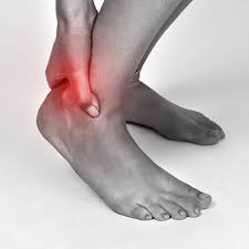 5 Home Treatments For Achilles Tendon Injuries