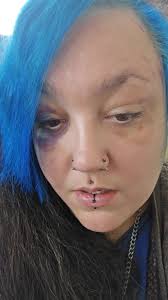 Anthony Blount Liver