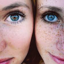 Sfw pics of girls with freckles. Facts About Redheads That May Surprise You 2019