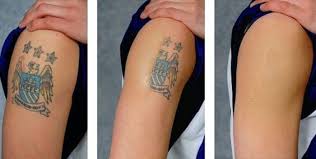 error diy tattoo permanent tattoo removal cream diy tattoo