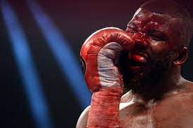 Despite the injury pouring with blood, jack was allowed to continue and. Mike Tyson Vs Roy Jones Jr Badou Jack Suffered Horrific Gash On Forehead On Pacquiao Vs Broner Undercard