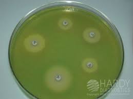 Recipe can be automatically scaled with desired volume. Mueller Hinton Agar Alchetron The Free Social Encyclopedia