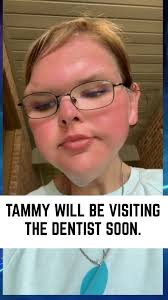 How much can one tooth cost?