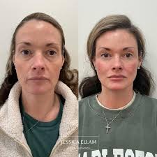 Happy National Aesthetician Day to one of the BEST! Vanessa is a licensed  aesthetician + and registered nurse! If you have had a treatment with her  then I'm sure you have LOVED