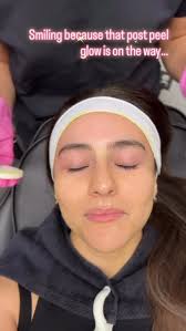 Fall is the perfect time to treat your face to some TLC. , 10% off all  services until Oct 31. , #biorepeel #medspa #skincare #chemicalpeel