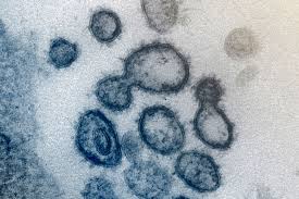 Mar 06, 2019 · digital painting is a new medium that lets us create beautiful artwork, without the messiness of painting with inks or oils. Coronavirus Variants Can Evade Antibodies By Spreading Via Supercells New Research Abs Cbn News