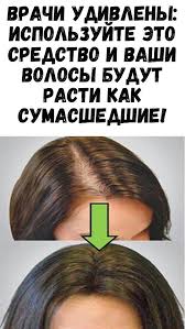 как ускорить рост волос на голове в домашних условиях Poleznosti V 2020 G Sovety Dlya Rosta Volos Lechenie Vypadeniya Volos Domashnie Maski Dlya Volos