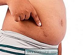 Check spelling or type a new query. Pembedahan Appendicitis Apabila Ia Ditunjukkan Dan Bagaimana Pemulihannya Gangguan Gastrousus