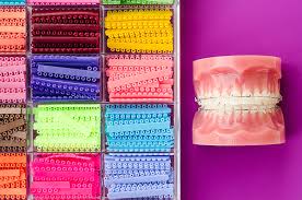 Maybe you would like to learn more about one of these? About Rubber Bands For Braces Biermann Orthodontics