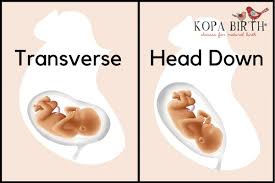 Find out from our midwife how and when your baby may be diagnosed as being in the transverse lie position, what it means for your pregnancy and how you will give birth. Week 27 Pregnancy Baby Position Symptoms Kopa Birth