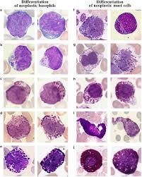 Image result for Basophil Count