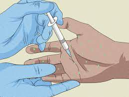 Apple cider vinegar can reduce excessive sweating by keeping your skin pores tight. 6 Simple Ways To Stop Sweaty Hands While Gaming Wikihow