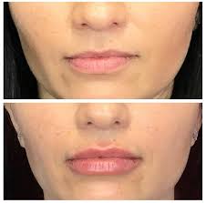 M Spa Face & Body added a new photo —...