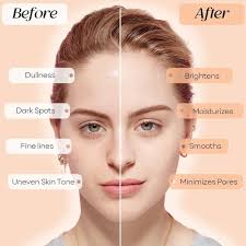 Amazon.com: 10% Vitamin C & Vitamin E Facial Serum, 30ml