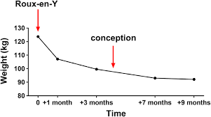 weight chart of the 26 year old lady with history of roux en