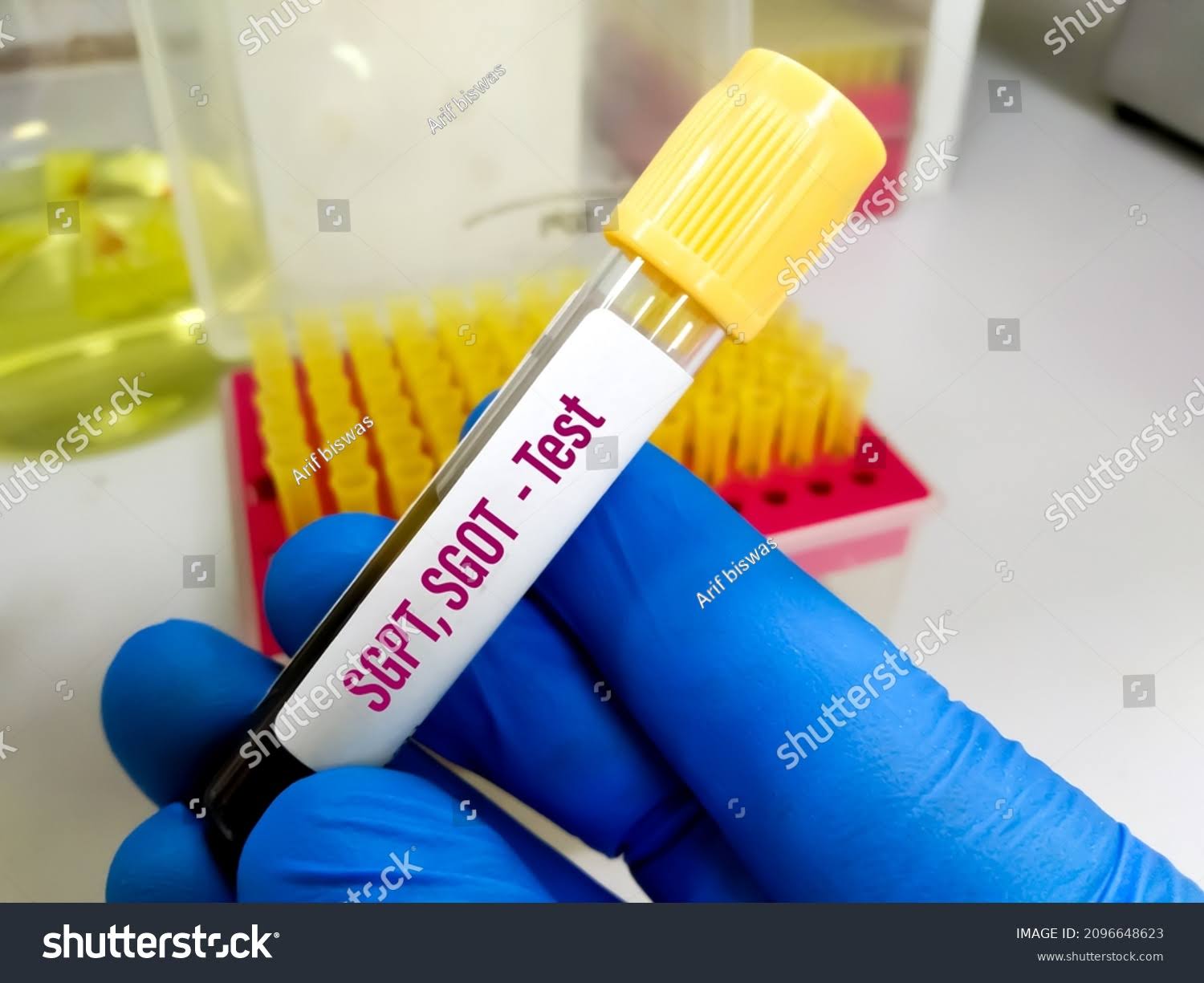 ALT / SGPT product image